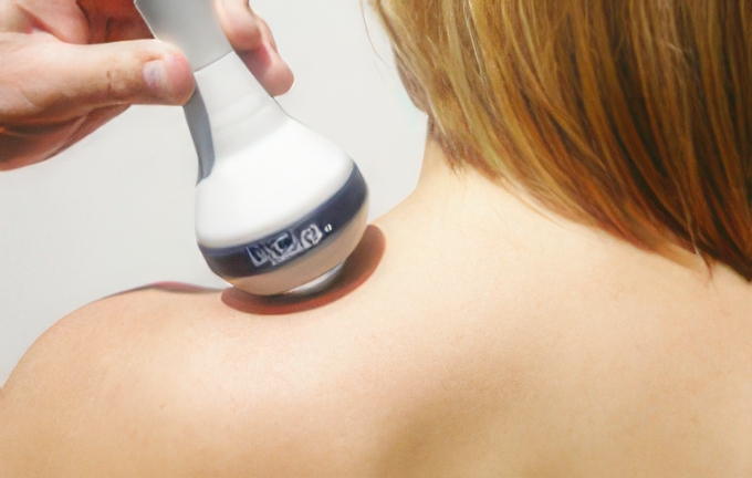 Deep tissue laser therapy being applied to the upper back and shoulder area using a LiteCure device